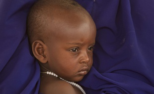 Un enfant tchadien attend une visite médicale avec sa mère