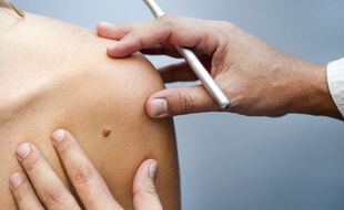 Une app pour analyser les grains de beauté et pathologies de la peau
