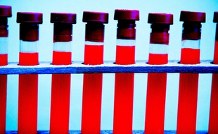 Tubes d'échantillons de sang. Illustration.