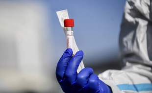 Désormais, le dépistage n'est plus systématique en cas de suspicion de coronavirus.