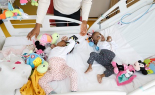 Bissie et Eyenga, soeurs siamoises, ont été séparées à Lyon en novembre 2019