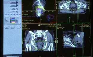 Le plan d'actions pour la radiothérapie du ministère de la Santé vise à garantir "qualité et sécurité" aux 200.000 malades traités chaque année par radiothérapie, a rappelé l'INCa dans un communiqué.