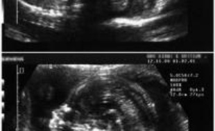 Les femmes qui ont accouché de foetus nés sans vie pourront désormais les inscrire symboliquement sur le registre de l'état civil et faire leur deuil en leur donnant une sépulture, selon des dispositions publiées vendredi.
