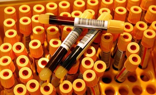 Des tubes de sang dans un centre de depistage du sida, anonyme et gratuit, à Paris.