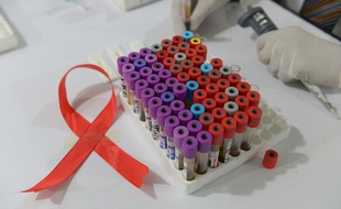 Illustration: sida, recherche et médecine.