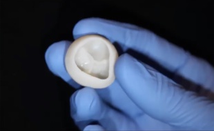 Une valve cardiaque fonctionnelle en collagène conçue par impression 3D.