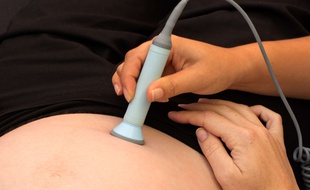 Monitoring d'une femme enceinte. (photo illustration)