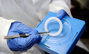 Actuellement en phase de test, l'anneau vaginal capable de protéger des infections sexuellement transmissibles pourrait être commercialisé en 2018.