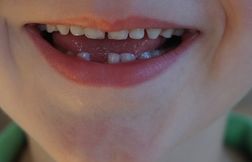 Des chercheurs planchent sur la régénérescence naturelle des dents