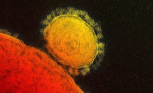 Image du coronavirus MERS fournie par l'Institut national des maladies infectieuses.