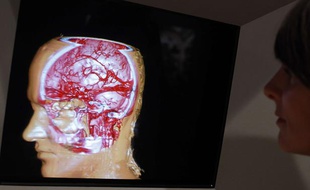 Imagerie cérébrale en 3D.