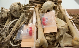 Au département d'anthropologie de l'Institut de recherche criminelle de la gendarmerie où ont été envoyés les ossements de Lauzès. Illustration.
