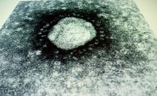 Trois cas suspects de contamination par le nouveau coronavirus, proche de celui du Sras, sont négatifs, tandis que pour un quatrième cas, un patient ex-voisin de chambre du malade atteint, "des examens complémentaires sont nécessaires", selon les résultats des tests.