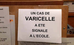 Un enfant est mort dans le Nord des suites d'une varicelle aggravée (illustration).