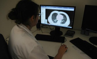 Un médecin regarde une raio des poumons à l'Institut Universitaire du Cancer de Toulouse (IUCT) le 4 juin 2015