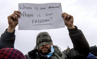 Un Iranien, les lèvres cousues en signe de protestation, le 2 mars 2016 dans le camp de "la Jungle" à Calais
