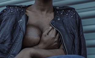 Cinq femmes aveugles ont été formées en Colombie à la méthode du Docteur Hoffmann pour détecter des tumeurs cancéreuses dans les seins des patientes.