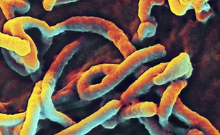 lE VIRUS eBOLA SE PROPAGE.