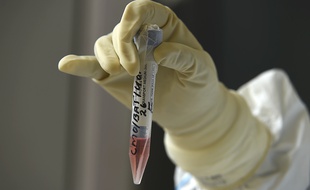 Un test de coronavirus, illustration
