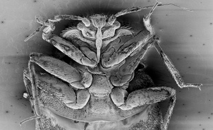 Une jeune punaise de lit, au microscope.