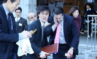 L'ambassadeur américain en Corée du Sud Mark Lippert quittant l'Institut culturel Sejong à Séoul après avoir été attaqué par un nationaliste coréen, le 5 mars 2015