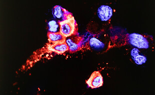 Des chercheurs de l'université de Hong Kong sont parvenus à isoler le variant Omicron du coronavirus SARS-CoV-2 à partir d'échantillons cliniques.