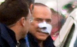 Silvio Berlusconi quitte l'hôpital après son agression par un déséquilibré, le 17 décembre 2009.