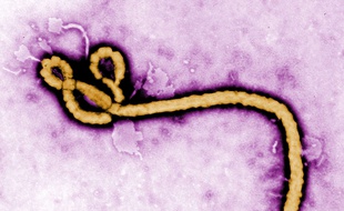 Le virus Ebola. Crédit: Frederick Murphy/CDC via AP