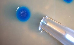 Colonies de bactéries Mycoplasma mycoides "transformées"