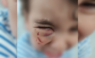 Un enfant de 2 ans a été blessé par une toxicomane, près de Stalingrad