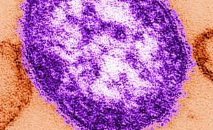 Le virus de la rougeole vu au microscope électronique.