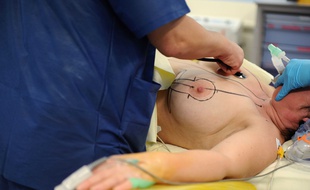 Une intervention durant laquelle une femme va se faire poser des emplants mammaires, le 5 janvier 2012.