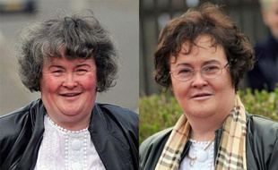 Susan Boyle avant/après