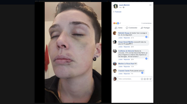 agression lesbienne