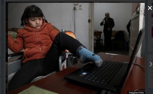Hu Huiyuan, victime de paralysie cérébrale. Et écrivain.