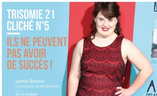 Une campagne cassons les clichés sur la trisomie 21 a été lancée sur facebook mi septembre 2016 par les parents de Louise.