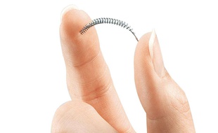 Parmi les méthodes de contraception définitive, ou stérilisation, ce micro implant posé dans les trompes bloque le passage des spermatozoïdes.
