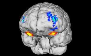 Des chercheurs lyonnais ont découvert que des zones différentes du cerveau sont stimulées par les plaisirs liés au sexe et à l'argent.