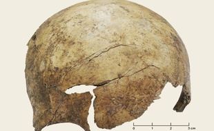 Un crâne retrouvé et étudié sur le site de Schöneck-Kilianstädten, près de Francfort.