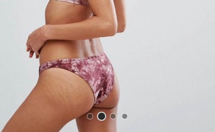 Le site Asos a publié des photos de mannequins non retouchées et laissant apparaître leurs vergetures.