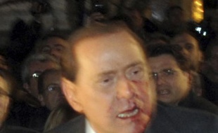 Silvio Berlusconi, touché par un coup de poing à Milan, le 13 décembre 2009.