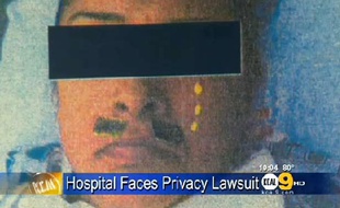 Capture d'écran d'une vidéo de la chaîne de télévision californienne KCal 9, montrant le visage de Veronica Valdez, orné d'une fausse moustache et de fausses larmes, lors de son opération au Torrance Memorial Medical Center.