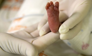 Illustration: le petit pied d'un bébé prématuré.