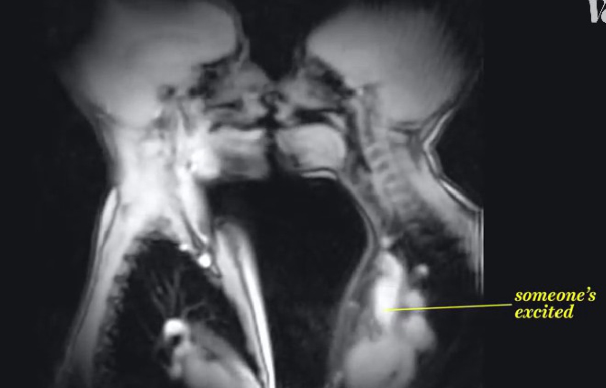 Une Relation Sexuelle Vue Par Une Irm