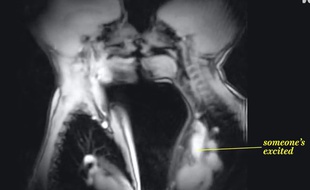 Un baiser vu par IRM.