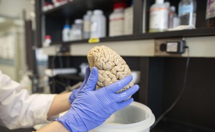 Un cerveau humain dans le laboratoire de recherche en neurologie de l'université Northwestern à Chicago le 29 juillet 2013.