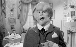 La vie de Joseph Merrick, surnommé «Elephan Man», a été adaptée au cinéma par David Lynch.