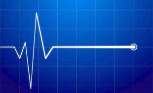 ElectroCardioGramme « plat »