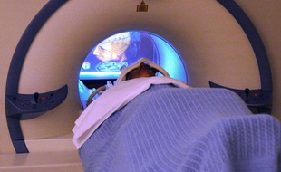 Examiner les poumons de gros fumeurs au scanner plutôt qu'aux rayons X permet de réduire de 20% la mortalité due au cancer du poumon, révèle une étude américaine parue jeudi.