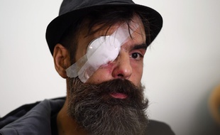Jerome Rodrigues, le 27 janvier 2019 à l'hôpital Cochin.